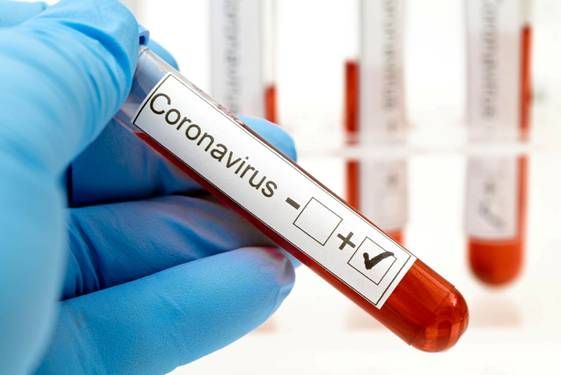 Koronawirus test