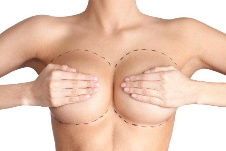 Implanty piersi - czy są bezpieczne?