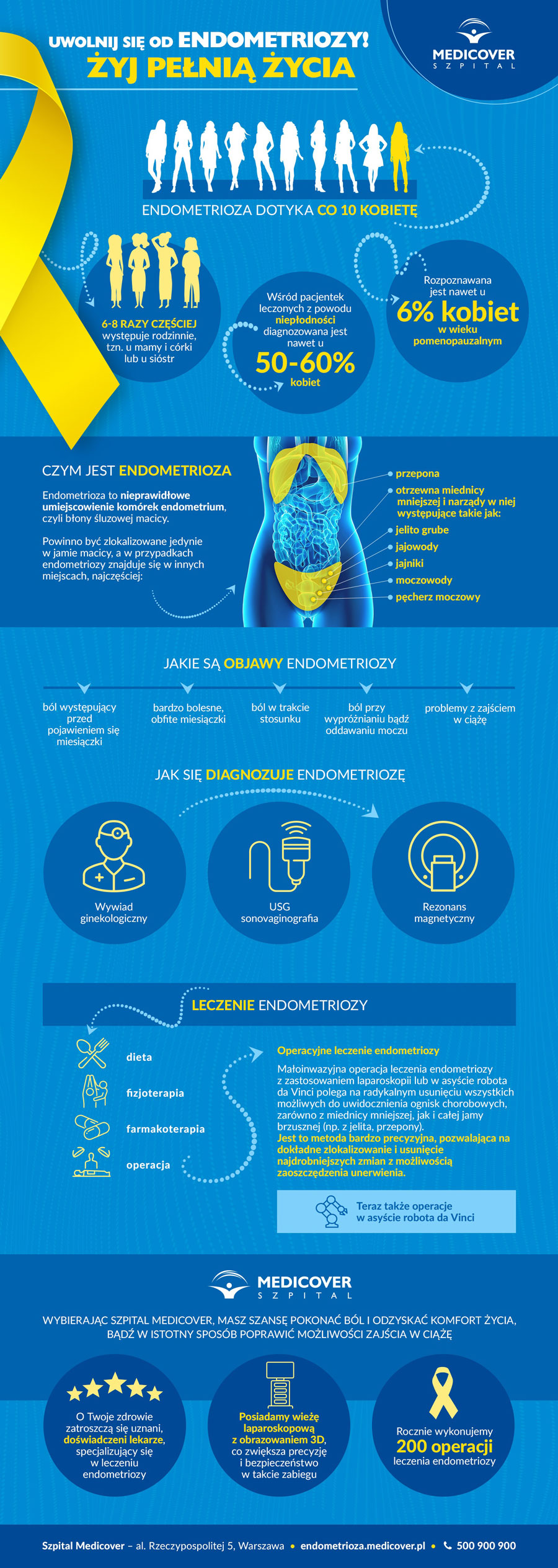 Endometrioza info